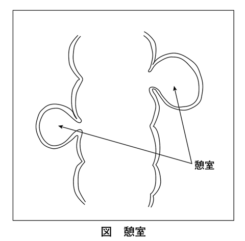大腸憩室症